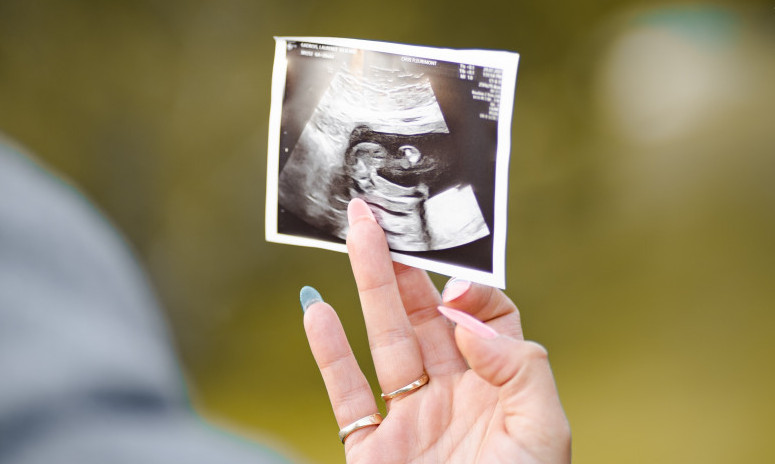 Kanzas na referendumu odlučio - ŽENE  IMAJU PRAVO na abortus