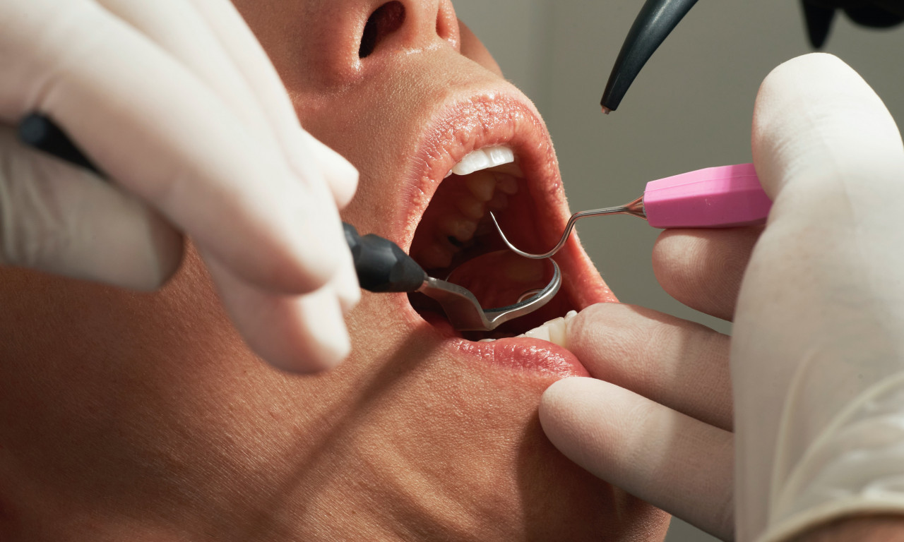 Ne, ovo NIJE FAKE NEWS: Zakazivanje kod zubara NEMOGUĆA MISIJA, Britanci SAMI VADE ZUBE