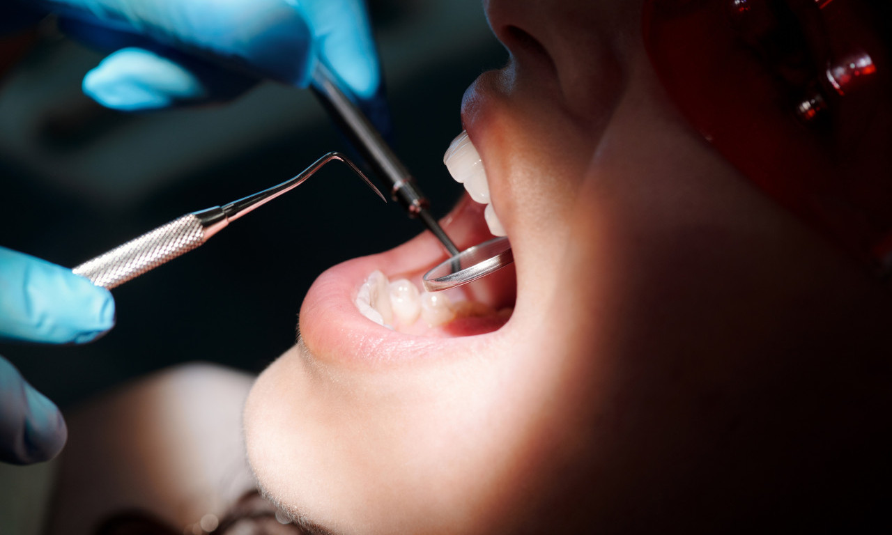5 stvari koje stomatolog nikad ne bi URADIO svojim ZUBIMA