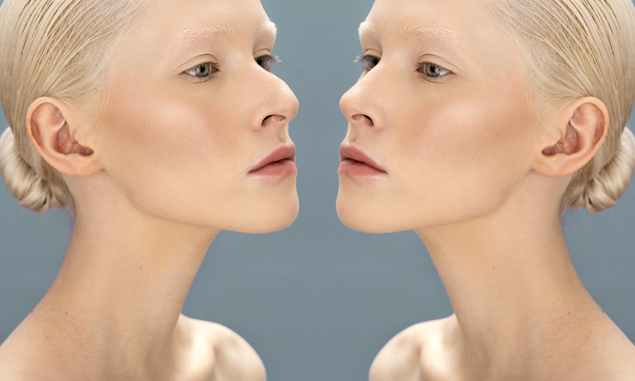 KAKAV NOS takav - KARAKTER: Postooji 8 tipova, KOJI STE VI?