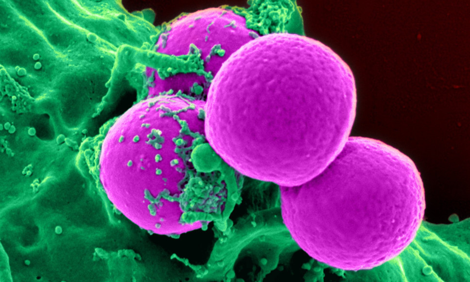 NAJGORA VEST 2026! NOVA PANDEMIJA NA POMOLU Svet u panici posle otkrića u Rumuniji, mikrob se budi posle 50 vekova!