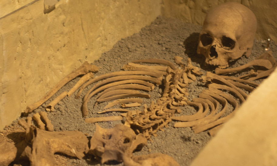 Otkriće koje MENJA SVE: Otkriveni dokazi da je pre 31.000 godina rađena - HIRURŠKA AMPUTACIJA