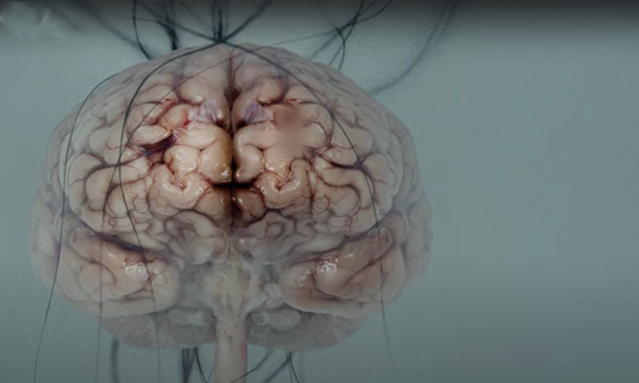 REVOLUCIONARNO ISTRAŽIVANJE O SMRTI Mozak može da zadrži određeni stepen svesti satima nakon umiranja