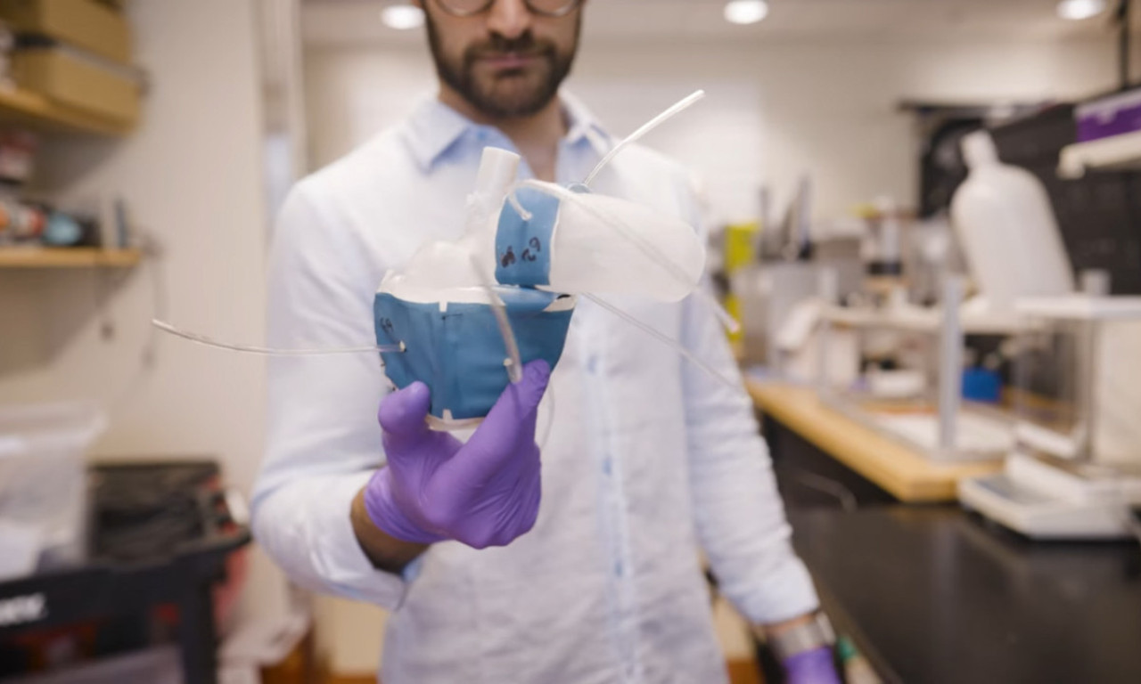 Lekari na 3D printerima ŠTAMPAJU REPLIKU SRCA pacijenta, da bi videli KAKO ĆE PUMPATI PRAVO