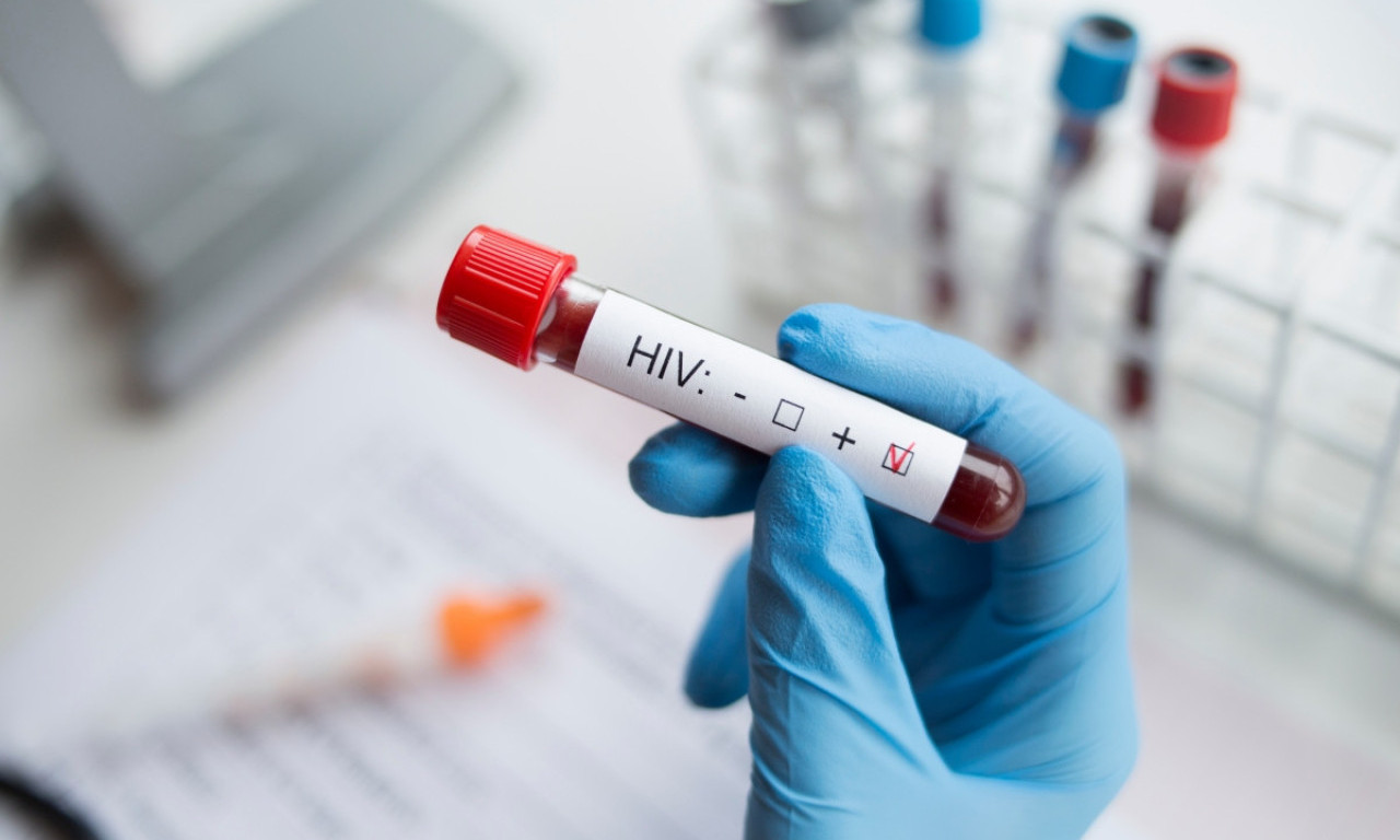 RUSI PRAVE VAKCINU PROTIV HIV-A! Naučnici na korak od revolucije, evo šta se dešava u laboratorijama