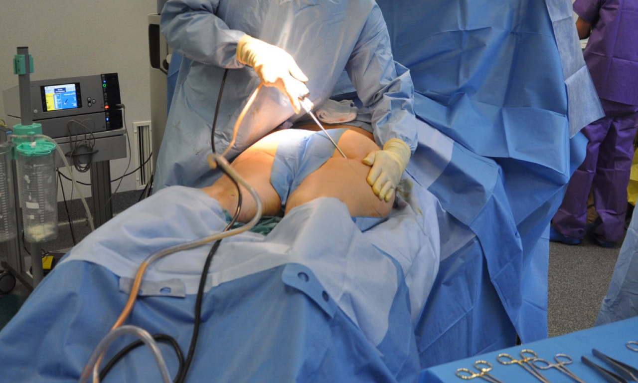 MILENA PREMINULA U TURSKOJ POSLE GREŠKE LEKARA Otišla na liposukciju pa izgubila život, evo šta se dogodilo