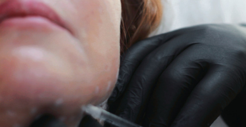 Kad pročitate šta sve BOTOKS radi LJUDIMA nikad nećete poželeti BOCKANJE i zatezanje