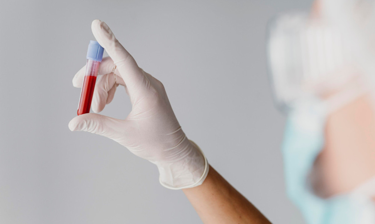 NOVA METODA ZA LEČENJA SEPSE MOGLA BI DA SPASI ŽIVOTE! Jedna stvar je ključna