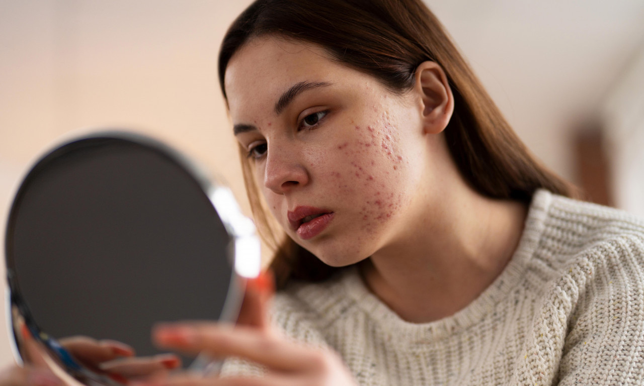 Naučite decu kako se neguje koža lica: Ovo su laki, kućni i efikasni tretmani, a najvažnije, ne koštaju čitavo bogatstvo