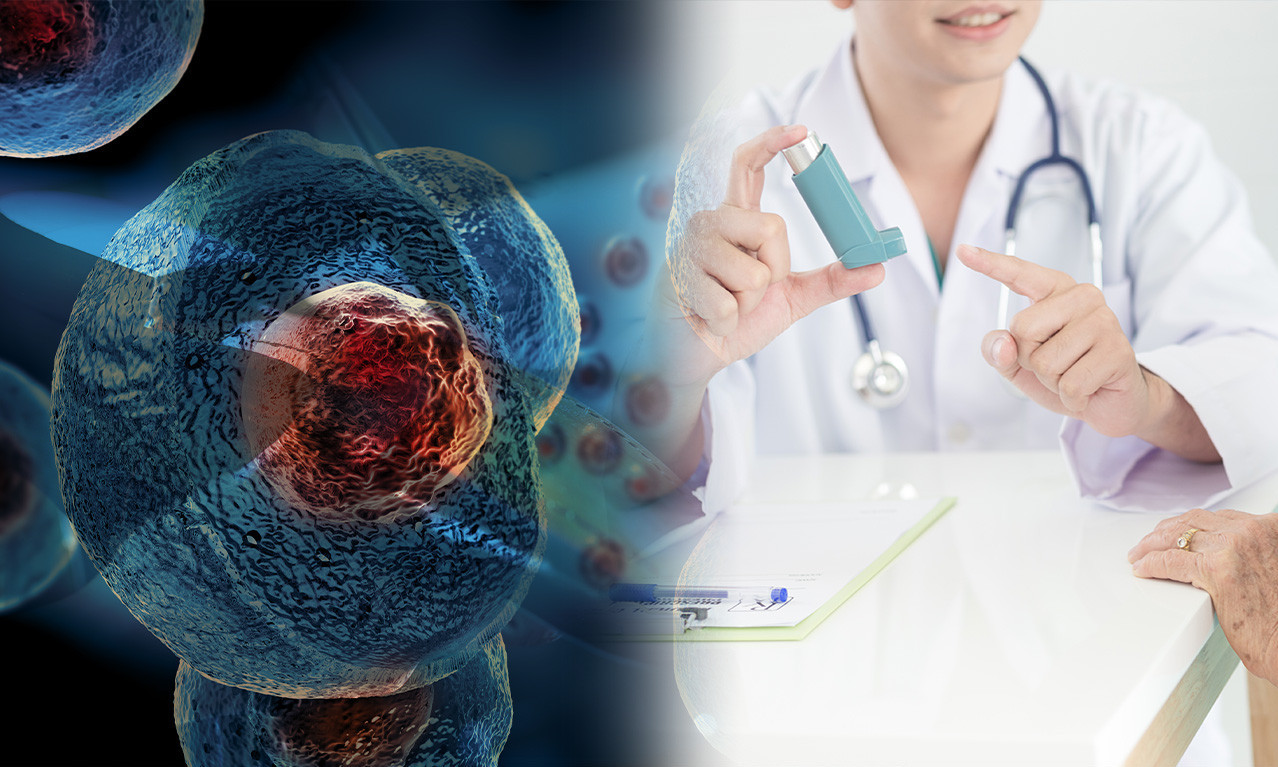 DA LI ZNATE ŠTA JE OLUJNA ASTMA? Nevreme može ubiti i one koji je nemaju, lekari upozoravaju na smrtonosni fenomen