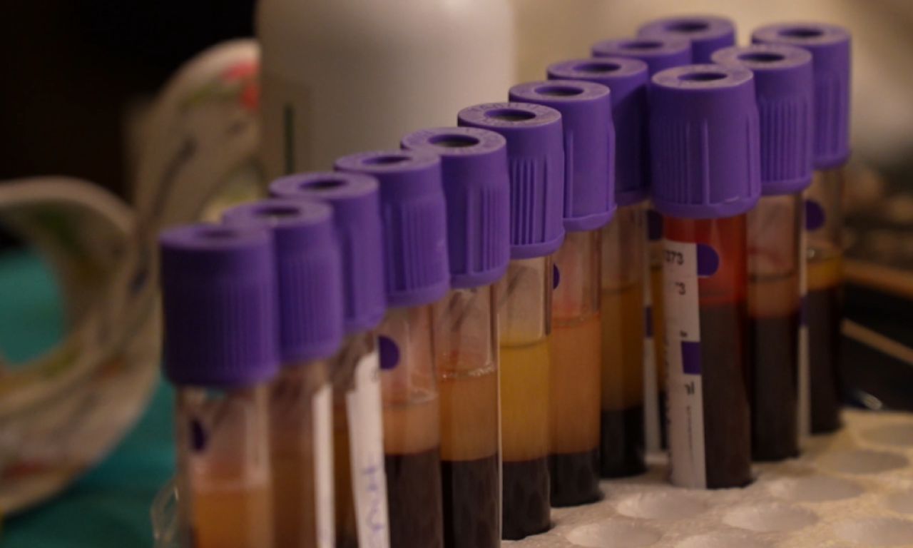 NOVA UREDBA VLADE SRBIJE Ovo su pravila za izvoz matičnih ćelija u inostranstvo