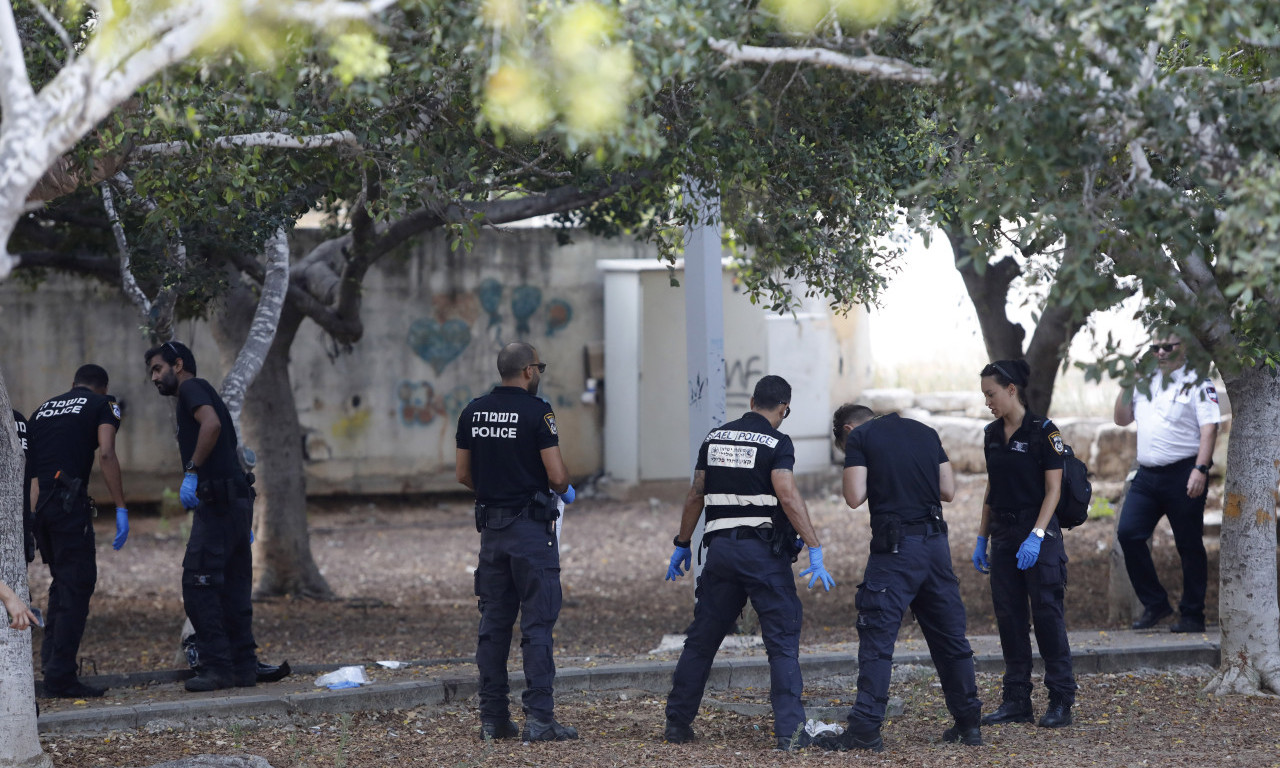 UČENIK (13) RANJEN NOŽEM PRVOG DANA U ŠKOLI Potukao se sa vršnjakom, pa dobio sečivo u nogu!