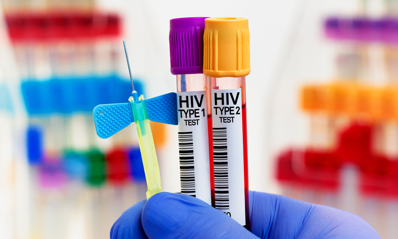 STIŽE INJEKCIJA ZA HIV! Daje se dva puta godišnje