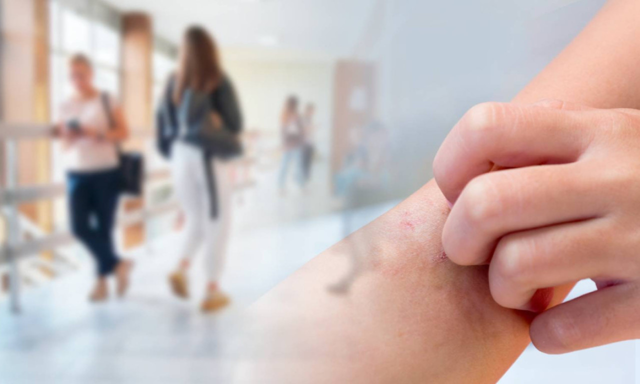 ŠUGA UŠLA U DEČIJE VRTIĆE! Zaraza se širi među odraslima, ima li mesta panici