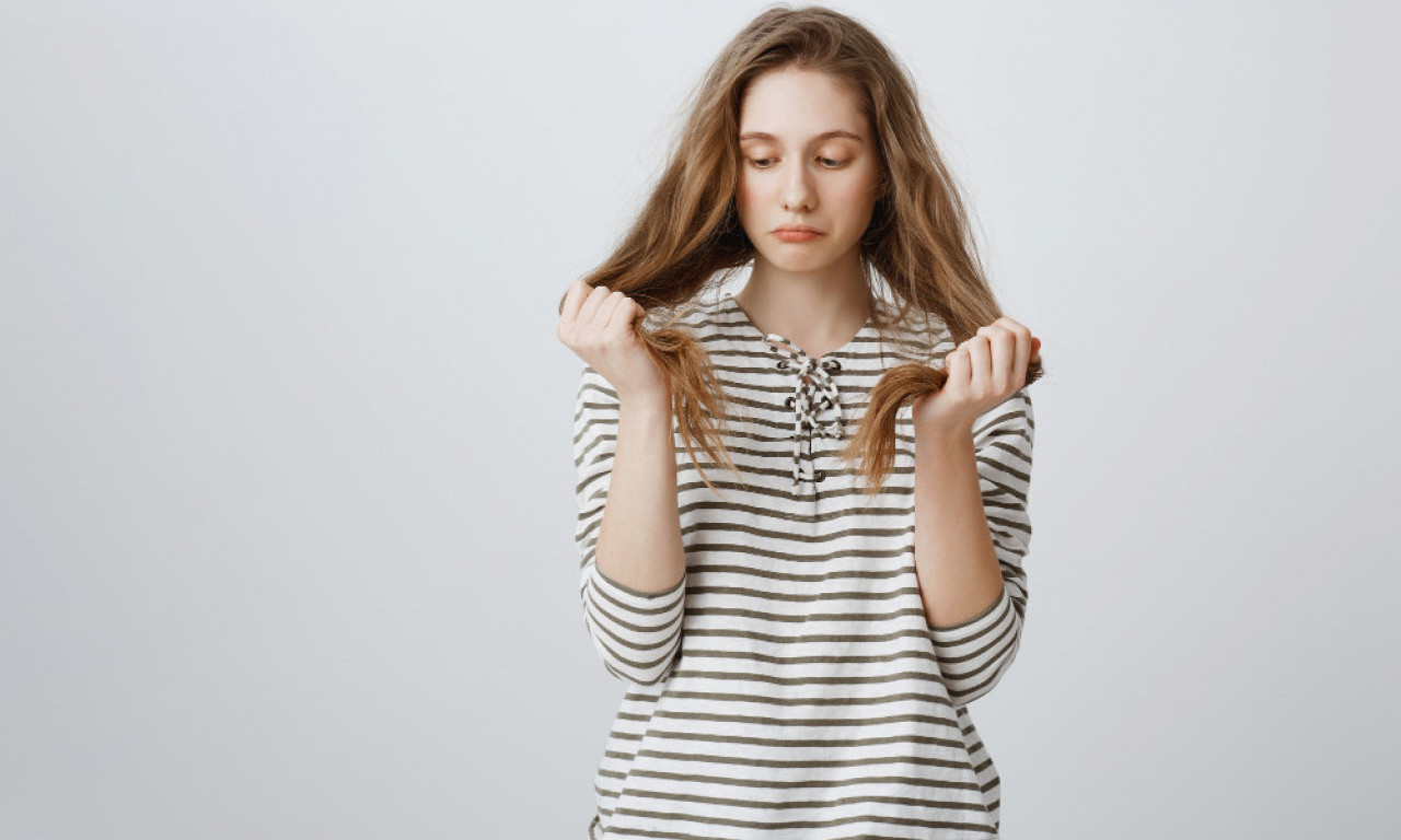 LEKOVI ZA MRŠAVLJENJE IZAZIVAJU GUBITAK KOSE Jedan od njih je popularan i kod nas