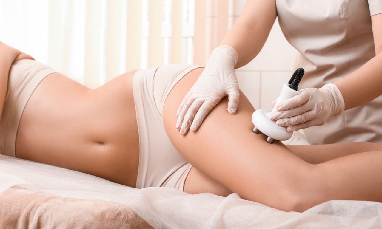 AWT TRETMAN – FANTASTIČAN, ALI SKUP Celulit nestaje, a i dinari s njim. Svi detalji zahvata koji je hit u svetu