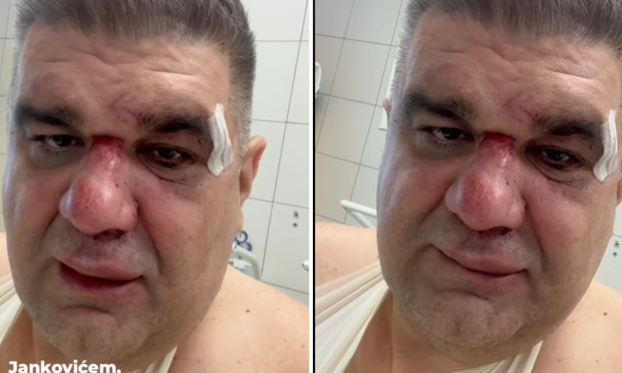 OPERISAN SAŠA MIRKOVIĆ! Od brutalnog prebijanja polomljeno mu više kostiju! Iz bolnice otkrio u kakvom je stanju (VIDEO)