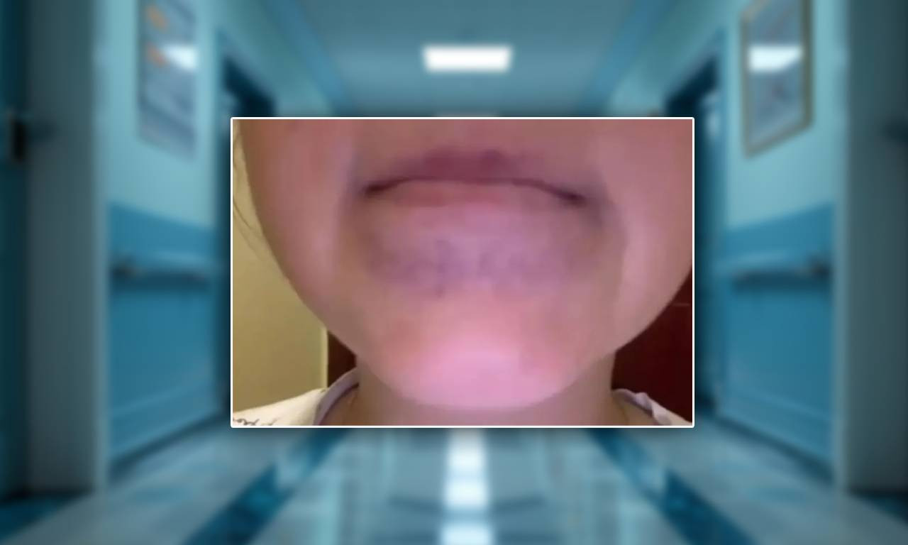 JEZIVA DRAMA U ŠAPCU! Dete pojelo dve kašike mlevenog paradajza, pa završilo u bolnici - očajna majka sve otkrila (FOTO)