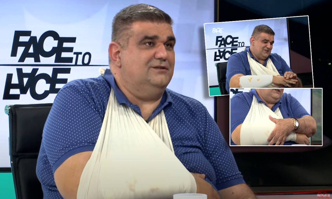 SAŠA MIRKOVIĆ SA SLOMLJENOM RUKOM PRVI PUT NA TV Pokušao je da me ubije pa je pobegao. Očekujem da ga policija privede!"