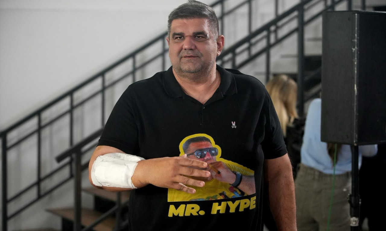 SAŠA MIRKOVIĆ TUŽI HOTEL U ZAGREBU Brutalno pretučen ispred ulaza, tvrdi da su ga ostavili bez zaštite!