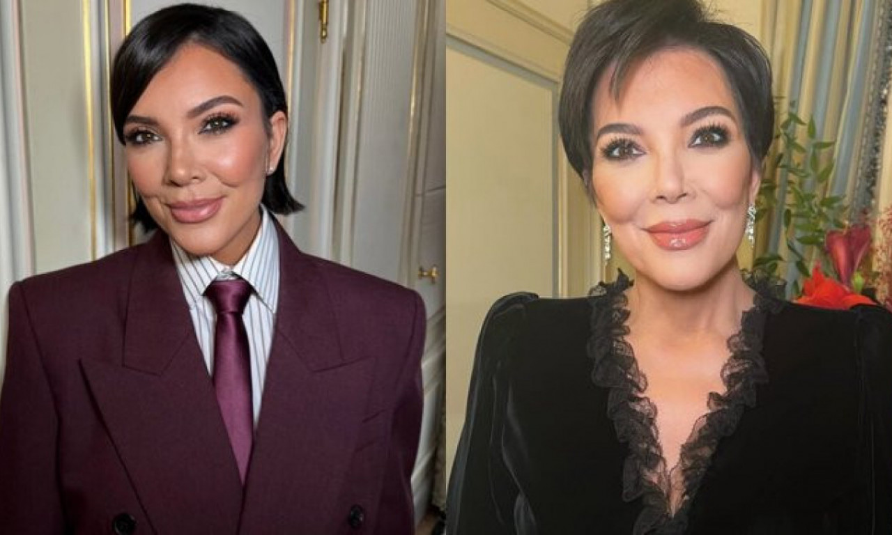 KRIS DŽENER IZGLEDA KAO DA IMA 30, A NE 70 GODINA! Upoznajte plastičnog hirurga zaslužnog za šok transformaciju (FOTO)