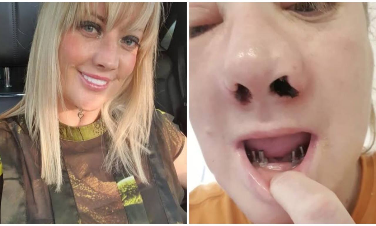 STRAŠNA DRAMA POZNATE DAME: „Bol je gora od porođaja, htela sam samo lepe zube“ – operacija koja je pošla po zlu!