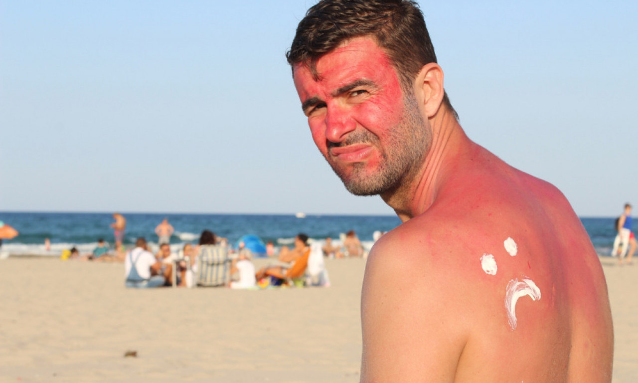 POMAGAJ, KAO RAK SAM! Ko je doživeo rekao je - koristite ove meleme za opekotine