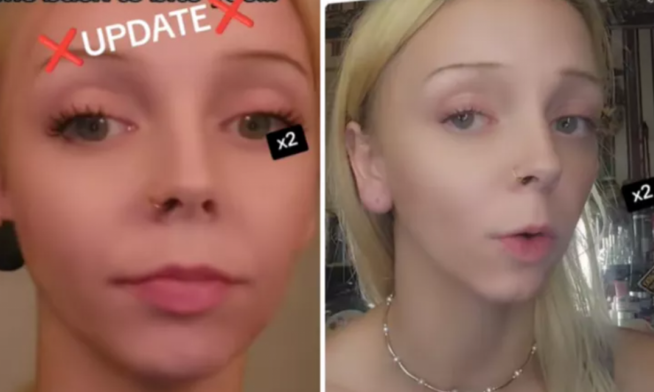 MLADA MAJKA POKUŠALA DA UBIJE OTROVNOG PAUKA, A ONDA JE NASTAO PAKAO: "Tkivo je već počelo da odumire..." (VIDEO)