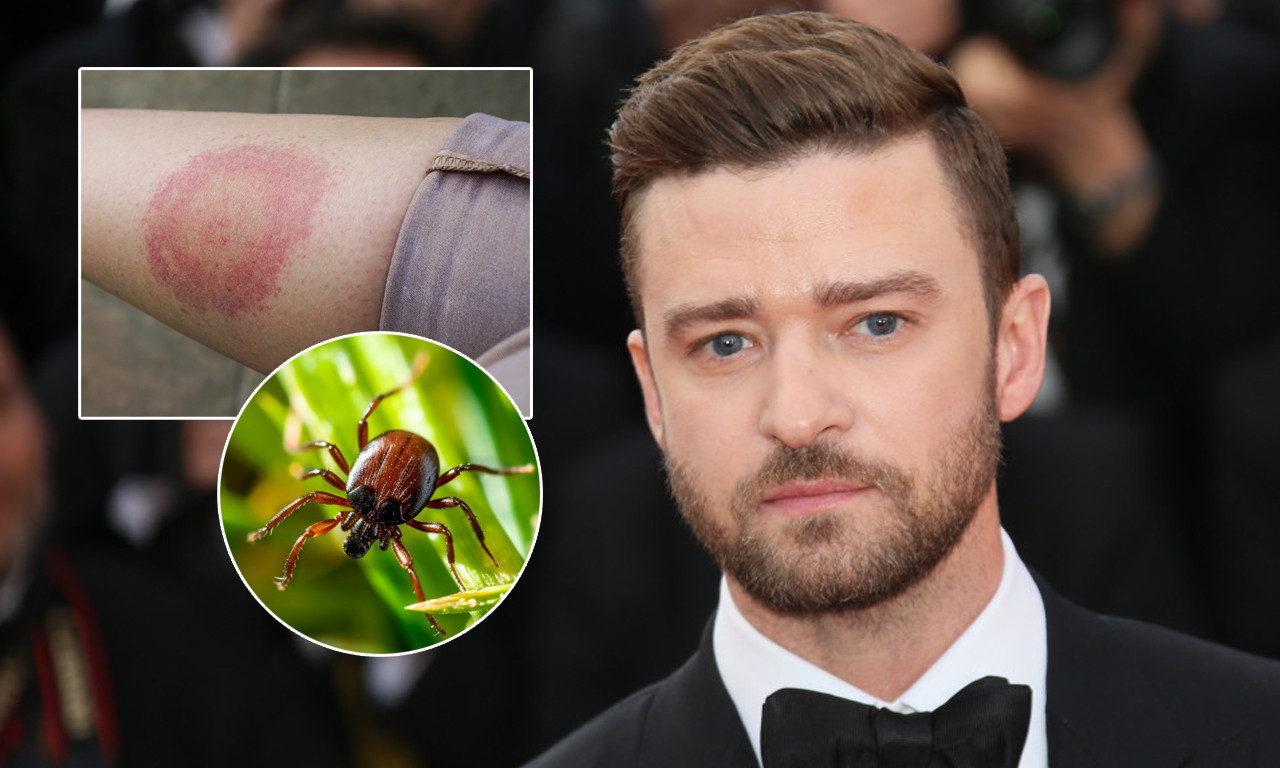 KRPELJ MU OKRENUO ŽIVOT NAOPAKO! Šta je lajmska bolest od koje boluje Džastin Timberlejk