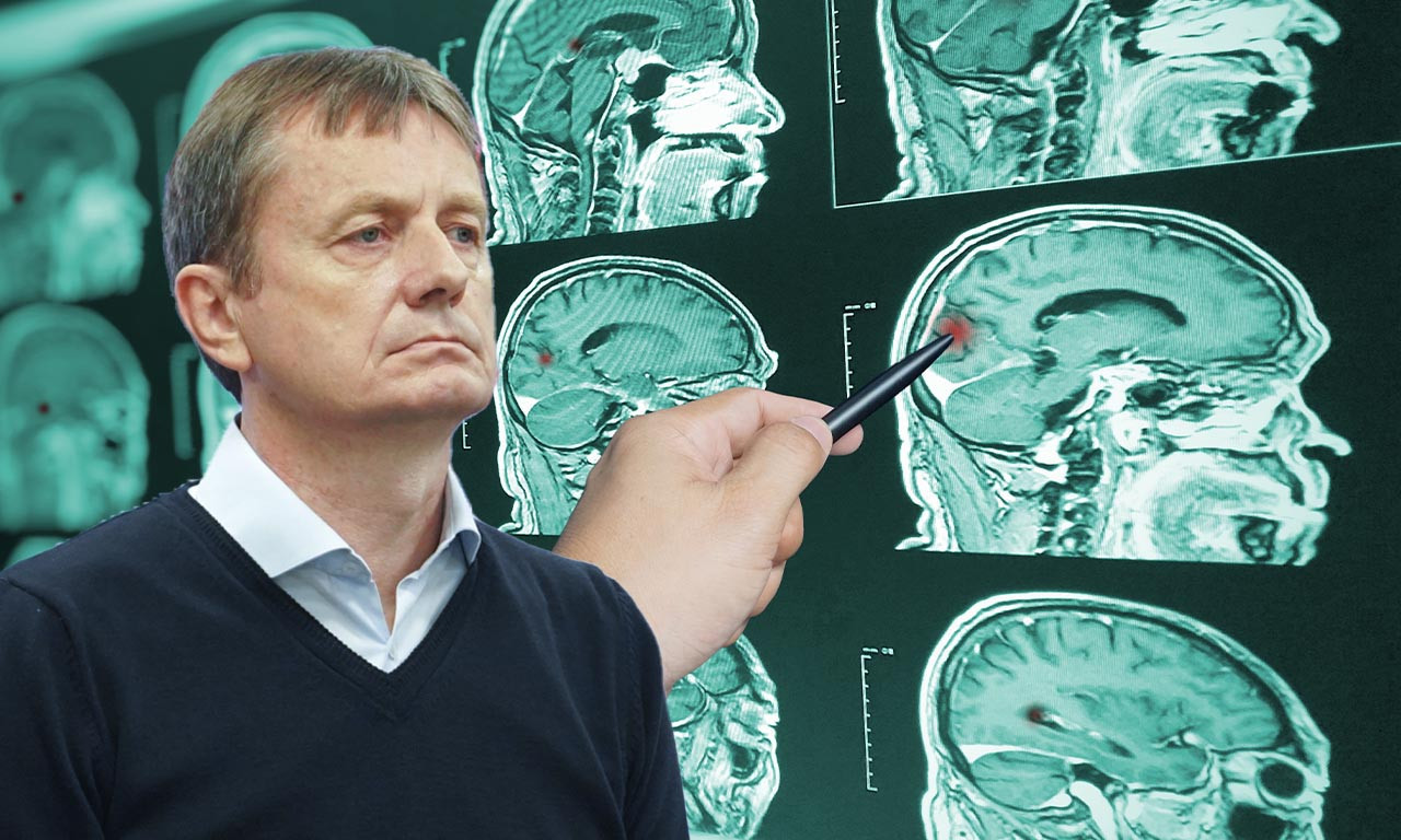 MOŽDANI UDAR KOJI JE IMAO DARKO GLIŠIĆ NE BIRA VREME NI MESTO Prepoznajte prve simptome – mogu spasiti život