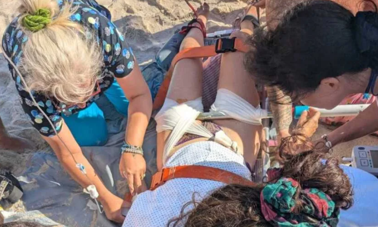 SUNCOBRAN SE ZARIO DEVOJCI U NOGU Panika na poznatoj plaži na Halkidikiju - hitno je imobilisana (FOTO)
