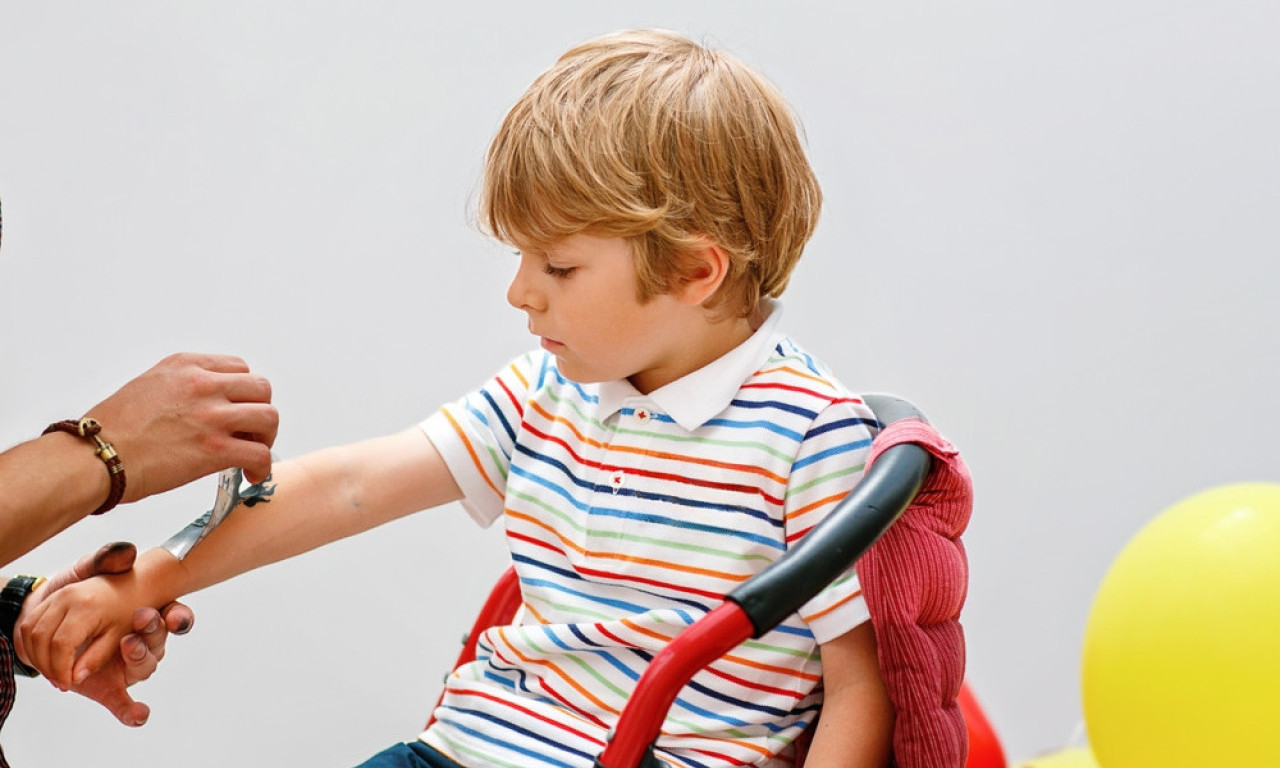 RODITELJI, OPREZ - PRIVREMENE TETOVAŽE SU OPASNE Mogu izazvati trajne alergije – evo šta kažu dermatolozi