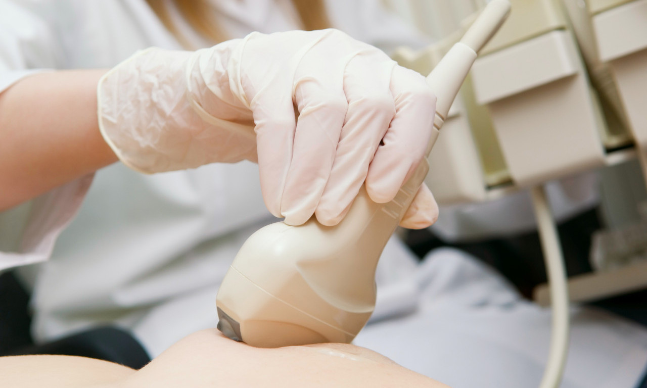 BESPLATNI PREGLEDI DOJKI NA KALEMEGDANU Evo kada možete da odete! (VIDEO)