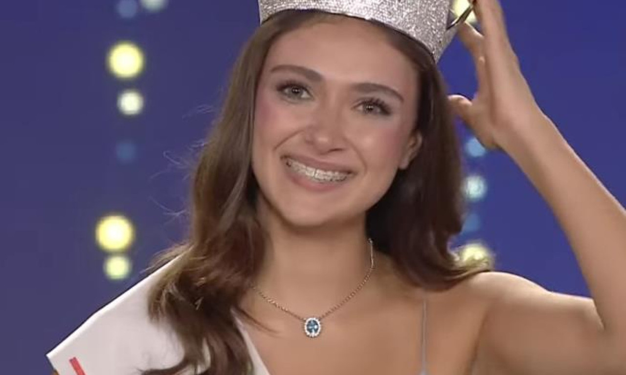 NOVA MISICA ITALIJE NOSI FIKSNU PROTEZU: Organizatori događaja istakli da "lepota evoluira"