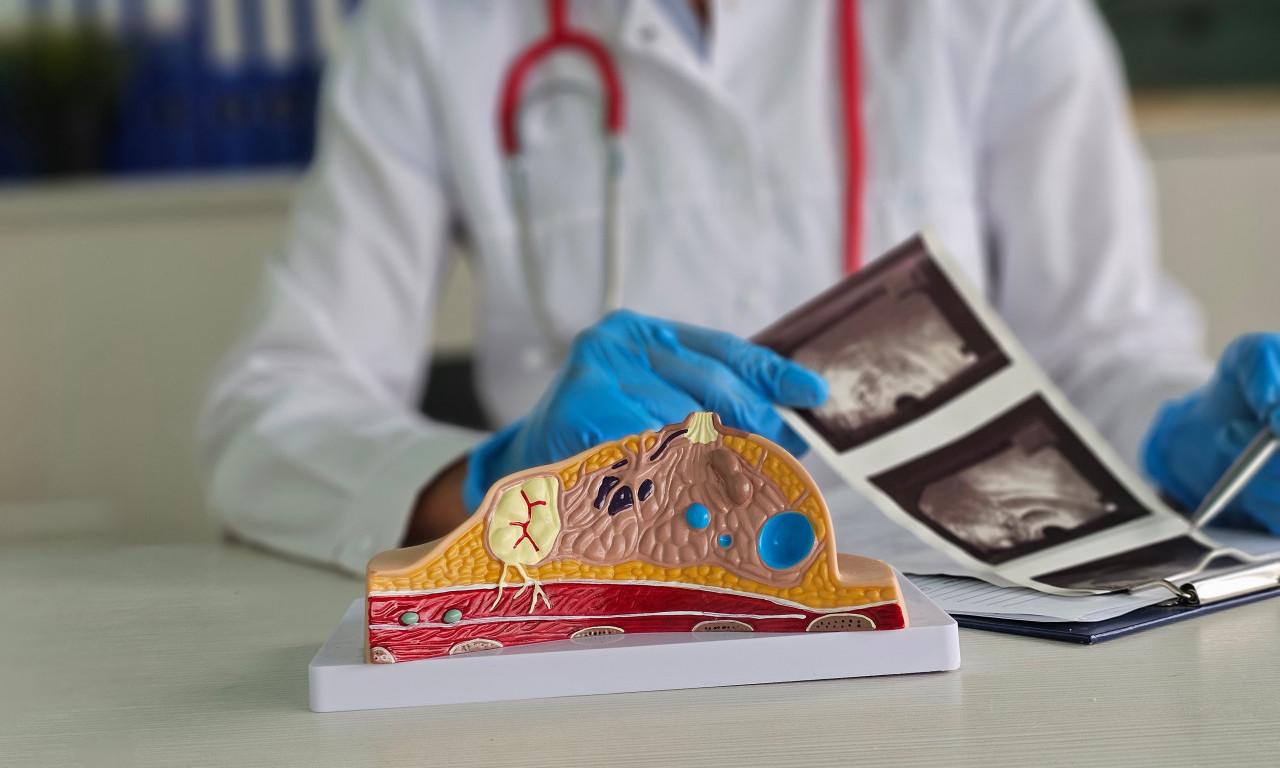 BESPLATNI PREGLEDI ZA ŽENE: U ovim mestima možete da odete na mamografiju!