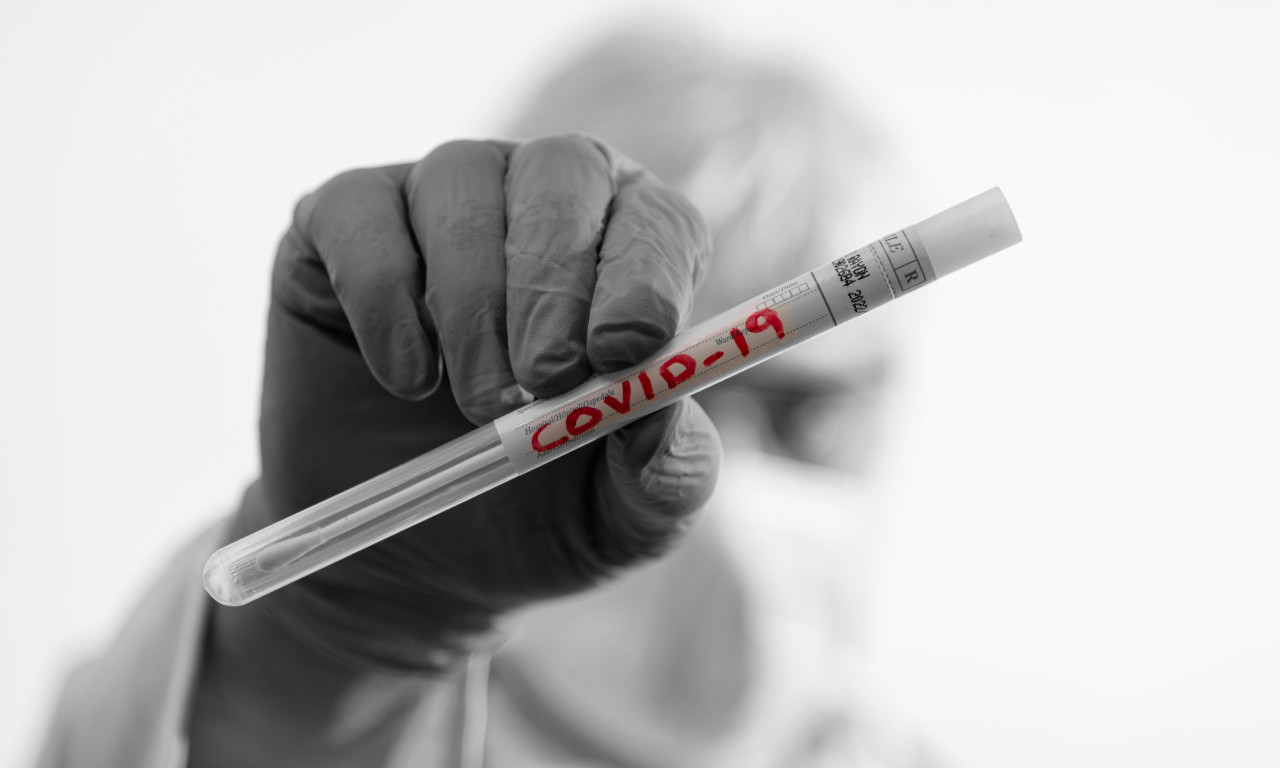 ZABRINJAVAJUĆE ISTRAŽIVANJE: Teški kovid i postkovid mogu da reaktiviraju uspavane viruse