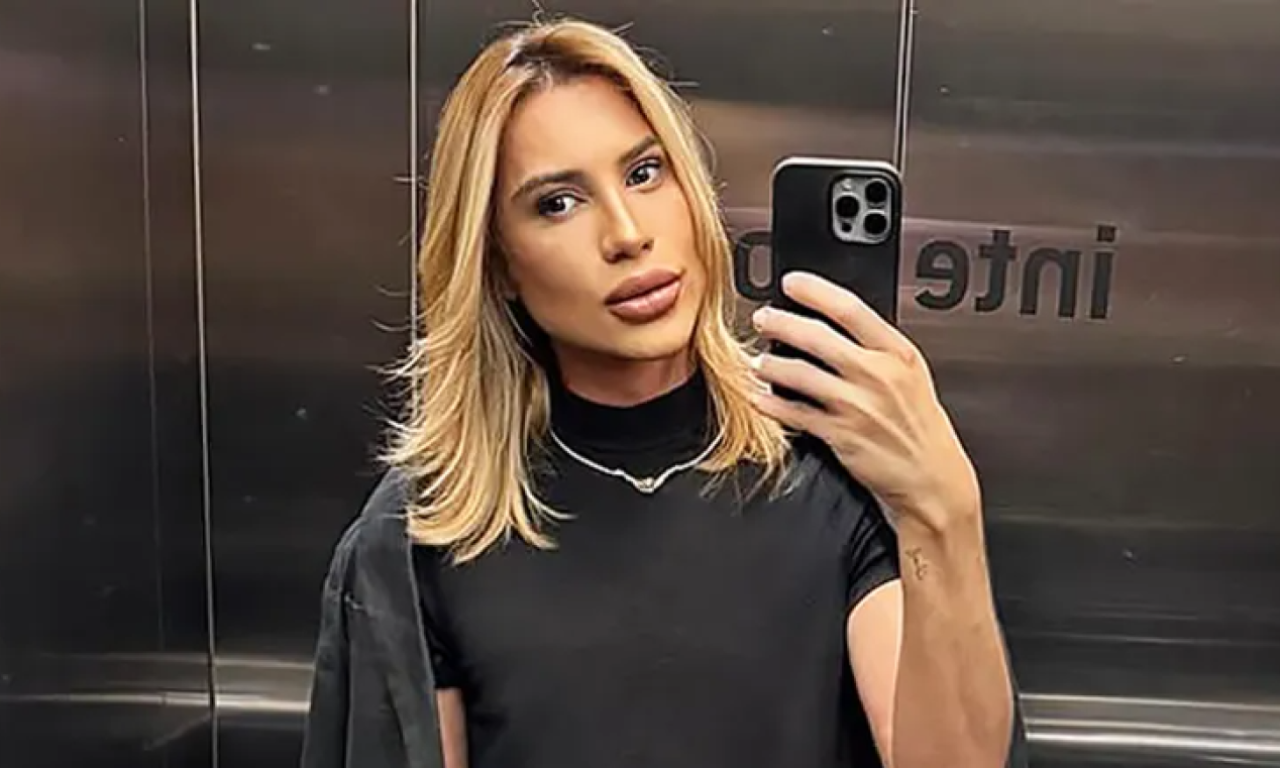 POZNATI INFLUENSER UMRO NAKON ESTETSKOG ZAHVATA Lice mu se pretvorilo u horor, oči mu operisao zubar