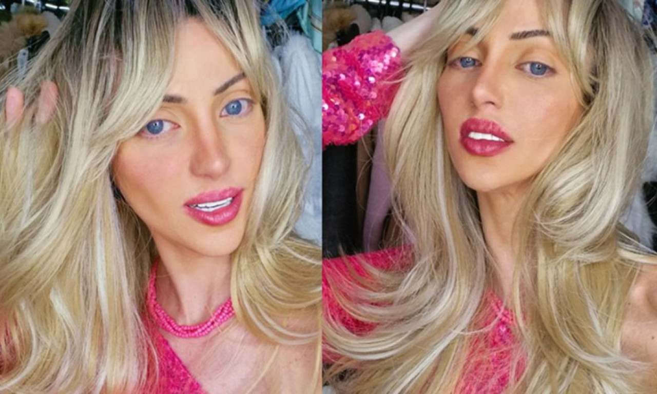 HUMAN BARBIE PREMINULA U 31. GODINI: Imala je 27 plastičnih operacija da liči na popularnu lutku (FOTO)
