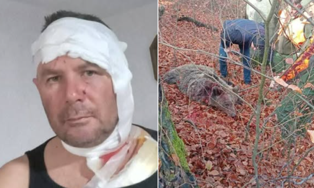 BOSANCA NAPALA DVA MEDVEDA I POČELA JE BORBA: "Zver me je uhvatila za glavu i zubima krenula ka licu" (FOTO)