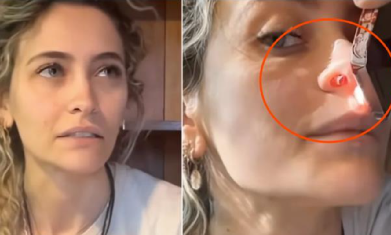 POKAZALA RUPU U NOSU Ćerka Majkla Džeksona otkrila šta joj je "ostalo" nakon zloupotrebe droga - šokirala svet (VIDEO)