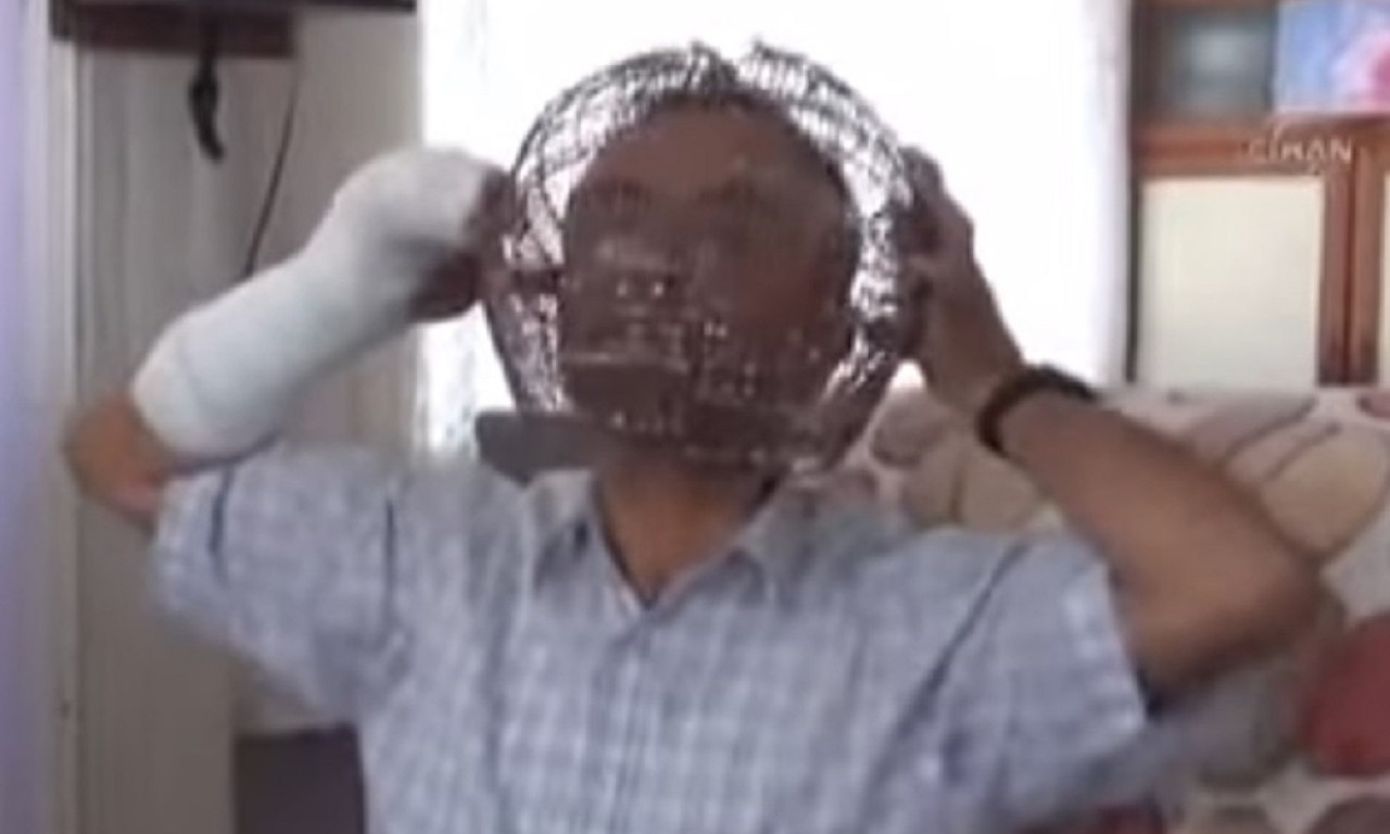 "ZAKLJUČAO" GLAVU DA BI PRESTAO DA PUŠI Turčin se uplašio posle smrti oca pa šokirao celu planetu (VIDEO)