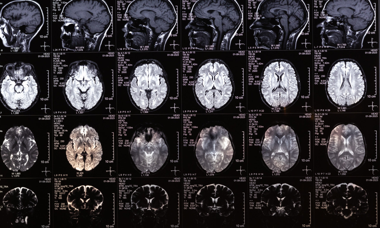 ZAŠTO SU 9, 32, 66. i 83. BITNE GODINE ZA NAŠ MOZAK? Ove ključne faze života potpuno preoblikuju um