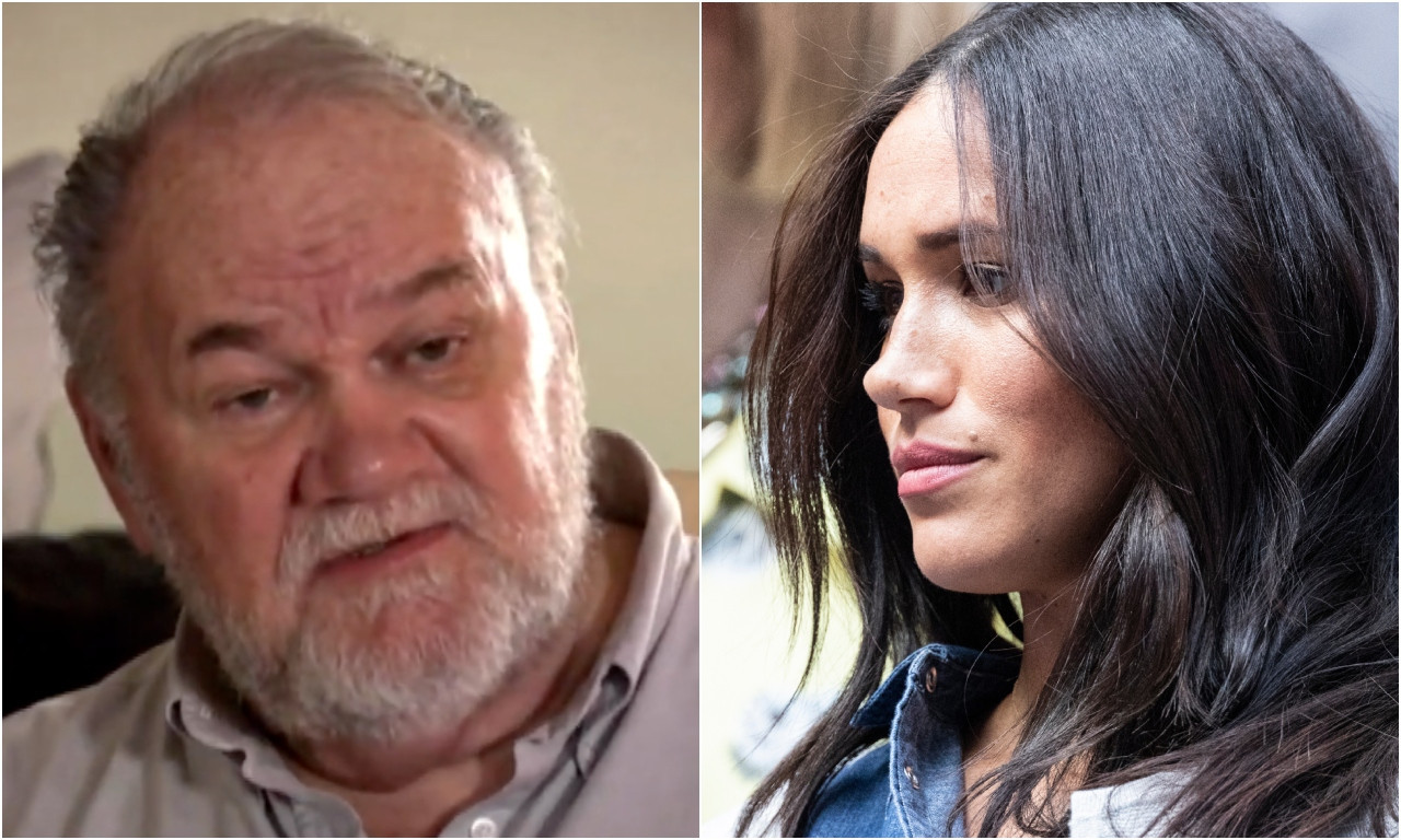 AMPUTIRANA NOGA OCU MEGAN MARKL! Stopalo mu je postalo plavo, a onda je počelo da crni, evo u kakvom je stanju