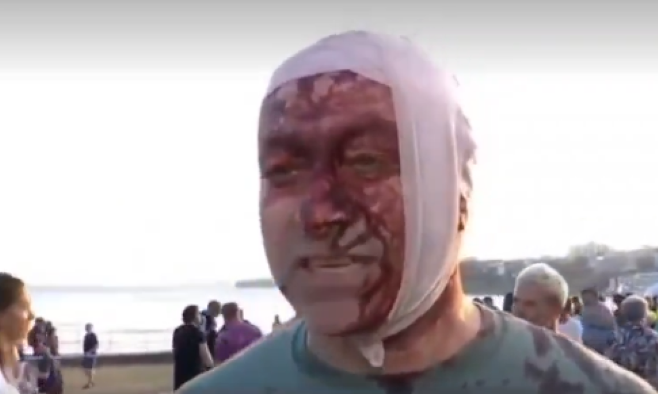 ARSEN JE BIO META TERORISTIČKOG NAPADA U SIDNEJU? Pogođen je u glavu: "Lekari kažu da je čudo da sam preživeo" (VIDEO)