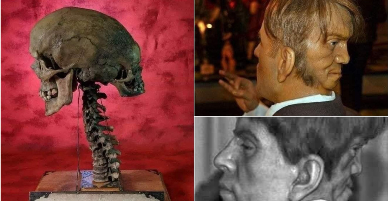 EDVARD JE ROĐEN SA DVA LICA, UPOZNAJTE GA... "Đavolji blizanac" mu je iza leđa šaputao grozote, dok se nije ubio u 23. godini (VIDEO)