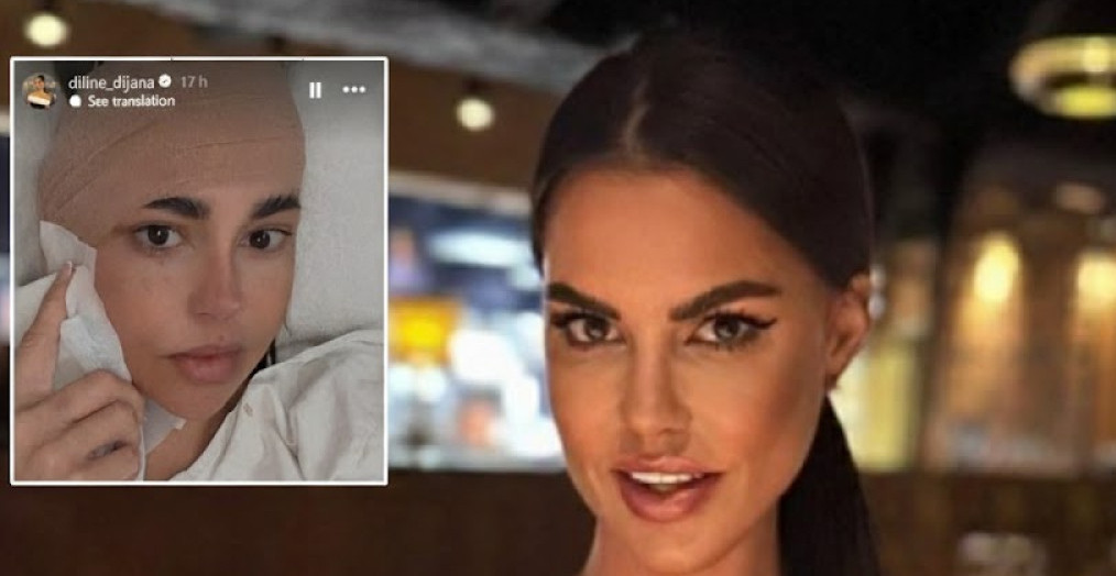 DIJANA DILAJN HITNO OPERISANA! Nakon jezivog udesa tri sata provela na operacionom stolu (FOTO+VIDEO)