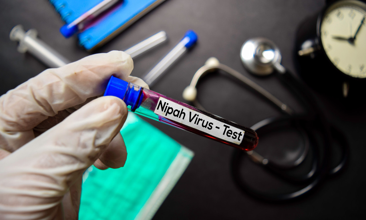 STREPNJE ZBOG SMRTONOSNOG VIRUSA Evo gde se širi opasna Nipa, vakcina još nije dostupna, smrtnost i do 75 posto