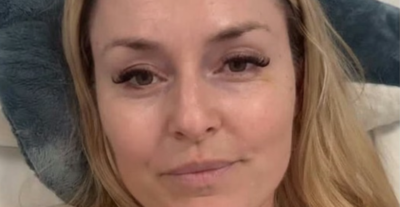 LINDZI VON IZ BOLNIČKOG KREVETA: „Nepokretna sam, čeka me nova operacija...“ - Potresne reči legende nakon jezivog pada! (FOTO)