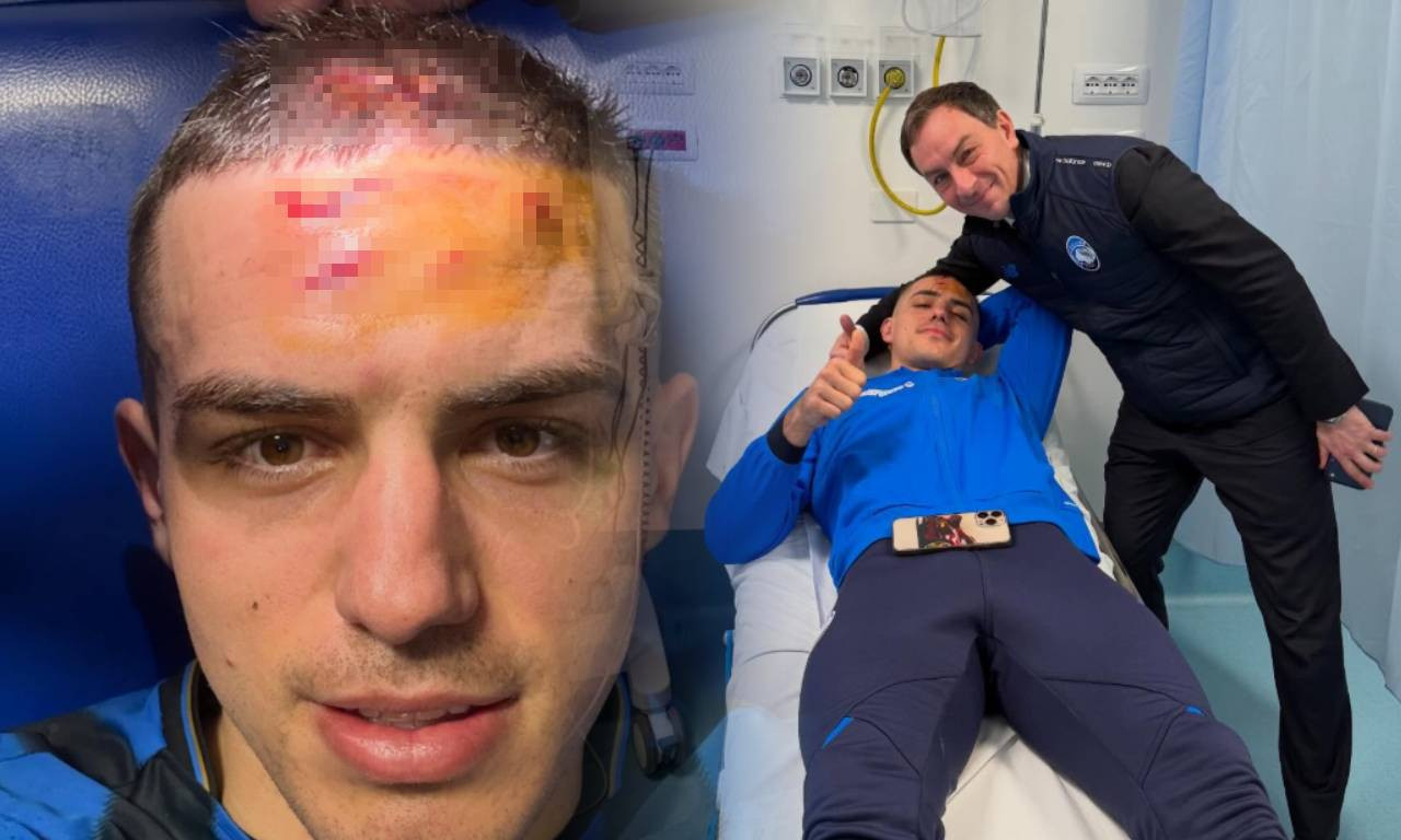 POGLEDAJTE KAKO IZGLEDA NIKOLA KRSTOVIĆ NAKON ŠTO JE DOBIO KOPAČKU U GLAVU: Prizor ledi krv u žilama (FOTO)