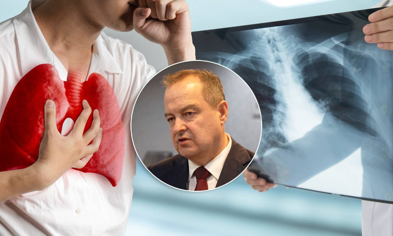 SVE O BOLESTI IVICE DAČIĆA Ne zanemarujte ove simptome i proverite da li ste u rizičnoj grupi